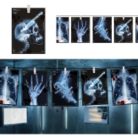 Slinger van röntgenfoto's van 3 m 16x22 cm